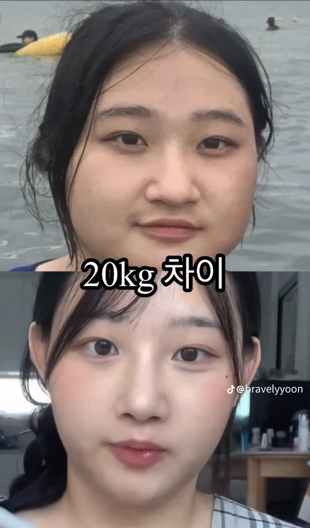 20kg 차이를 얼굴사진으로 보여주는 여자
