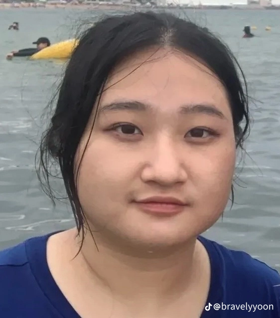 20kg 차이를 얼굴사진으로 보여주는 여자